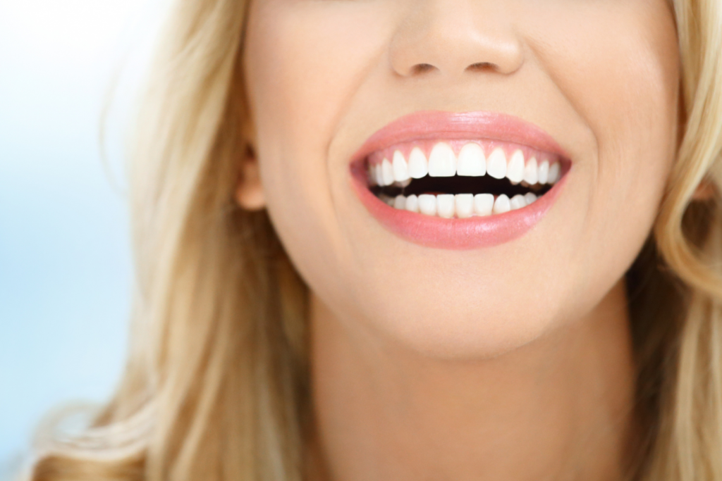 Kompozit bonding ve lamina veneer uygulamalarını gösteren estetik diş hekimliği değerlendirme görseli.