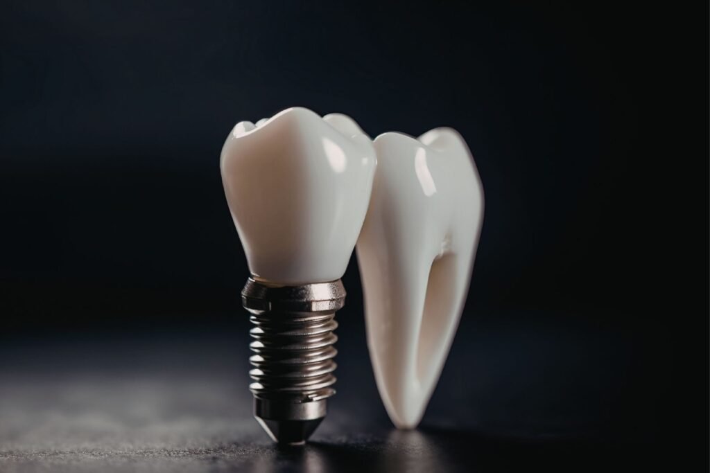 Dental implantlar üzerine planlanan sabit ve hareketli protezlerin ağız içinde değerlendirildiği protetik diş hekimliği görseli.