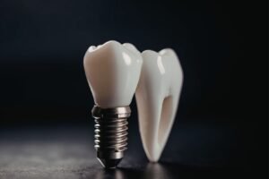 Dental implantlar üzerine planlanan sabit ve hareketli protezlerin ağız içinde değerlendirildiği protetik diş hekimliği görseli.