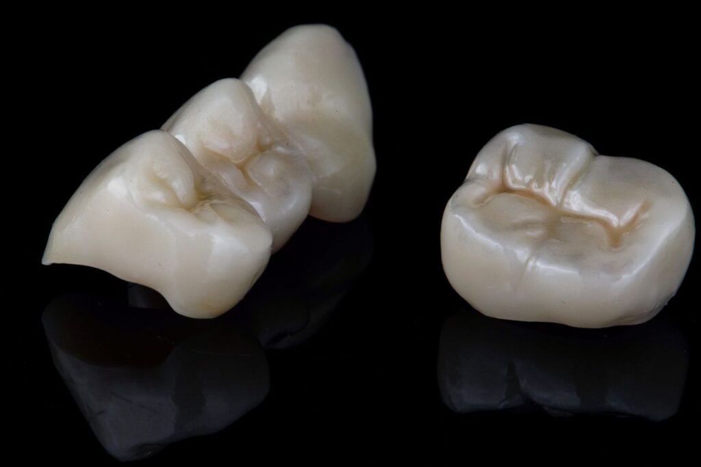 E-Max lityum disilikat ve zirkonyum diş kaplamalarının renk, ışık geçirgenliği ve materyal yapısı açısından karşılaştırılması.