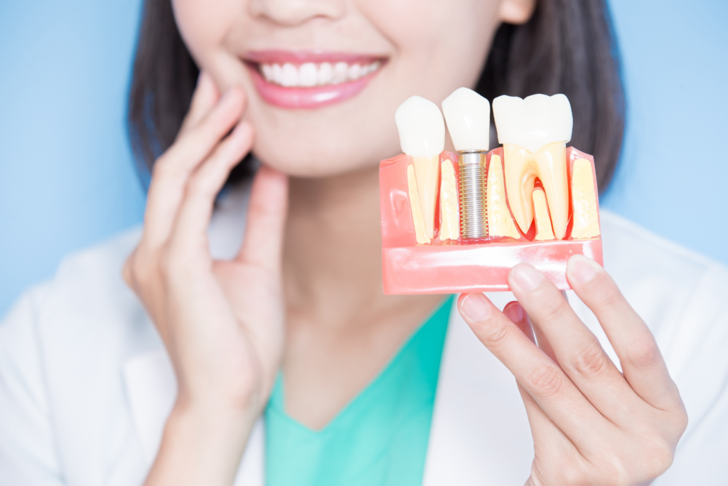 Dental implant tedavisinde çene kemiğine yerleştirilen implantın iyileşme ve protez uygulama aşamalarını gösteren çizim.